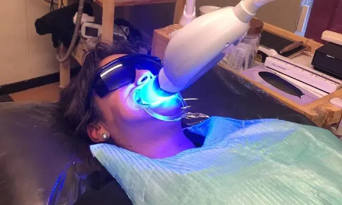 Teeth Whitening Session from La Glace Beauty Clinic