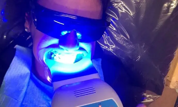 Teeth Whitening Session from La Glace Beauty Clinic
