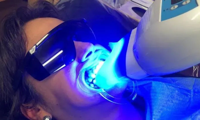 Teeth Whitening Session from La Glace Beauty Clinic